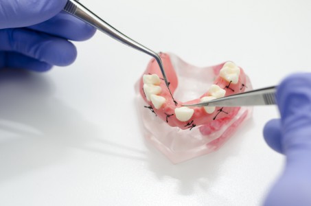 Dentist observing dental jaw model