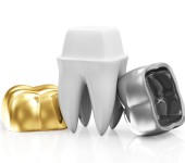 Refine Dental Metal