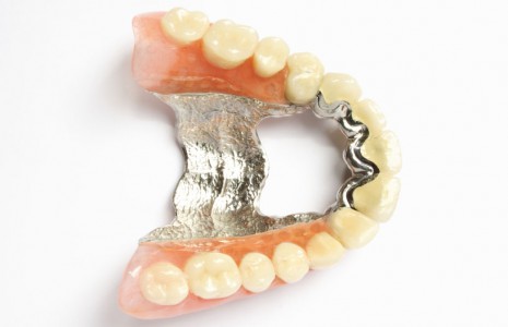 Dental Scrap Refining